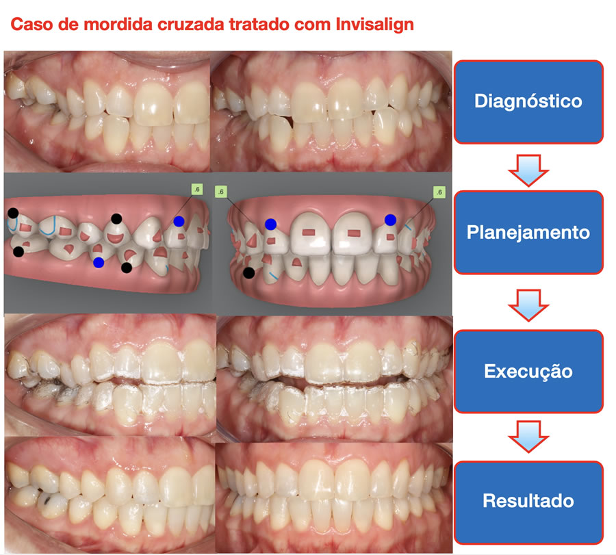 Caso1