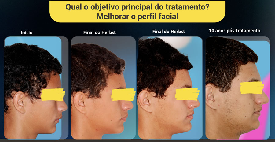MelhoraPerfil