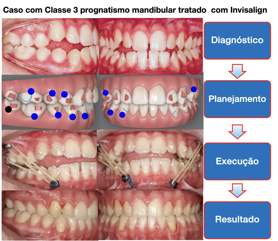 caso2