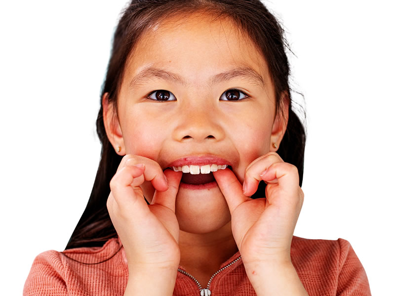 palatal1