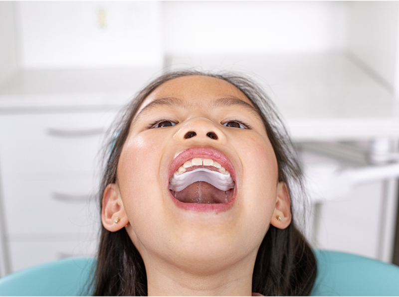 palatal2