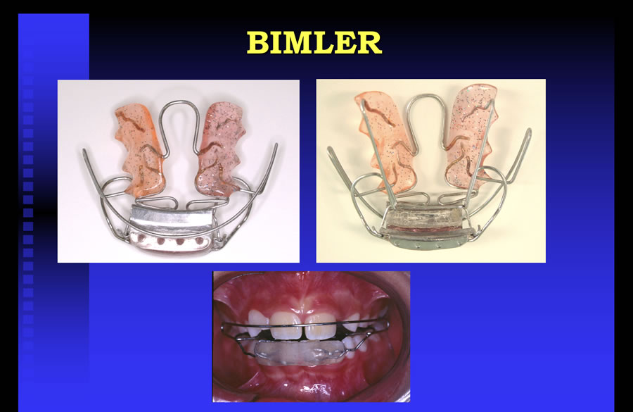 Bimler