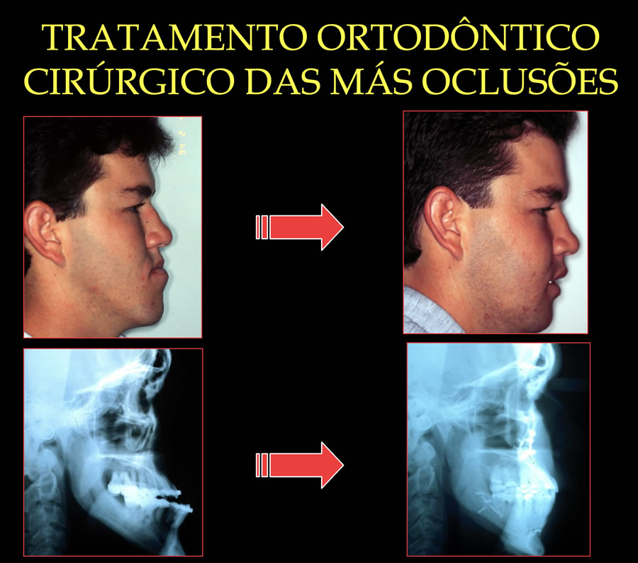 CasoTratadoCirurgia