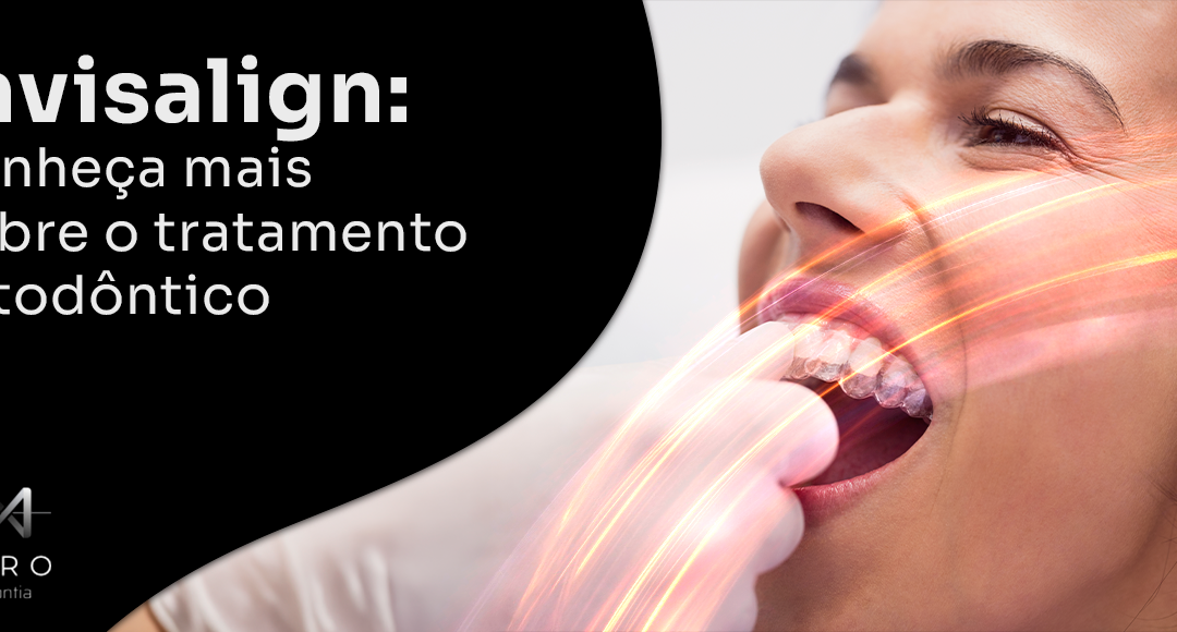 Invisalign: conheça mais sobre o tratamento ortodôntico