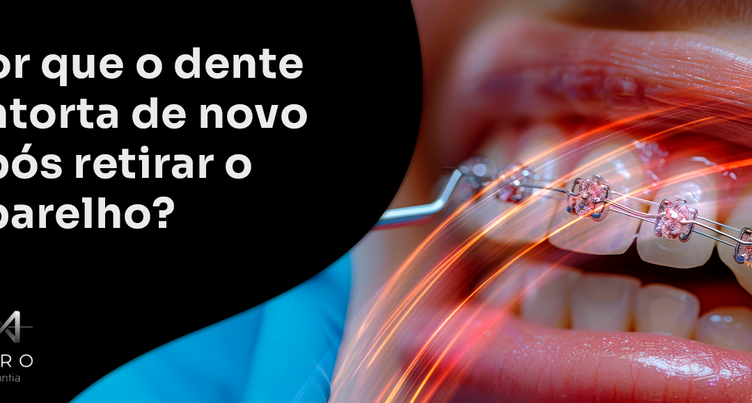 Por que o dente entorta de novo após retirar o aparelho?