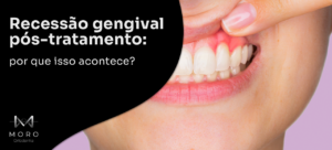 Recessão gengival pós-tratamento: por que isso acontece?