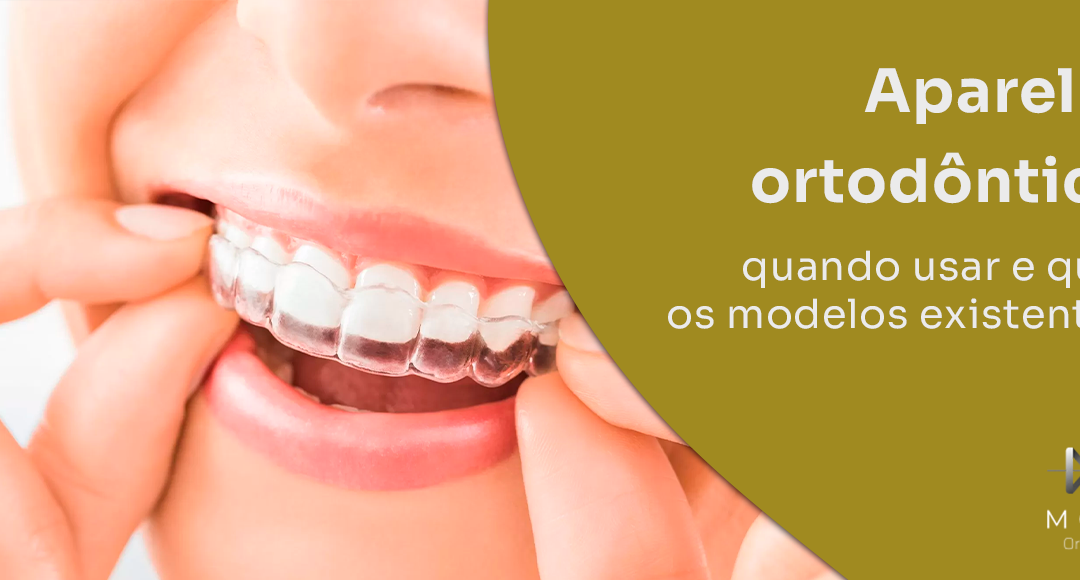 Aparelho ortodôntico: quando usar e quais os modelos existentes?