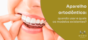Aparelho ortodôntico: quando usar e quais os modelos existentes?