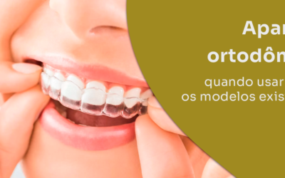 Aparelho ortodôntico: quando usar e quais os modelos existentes?