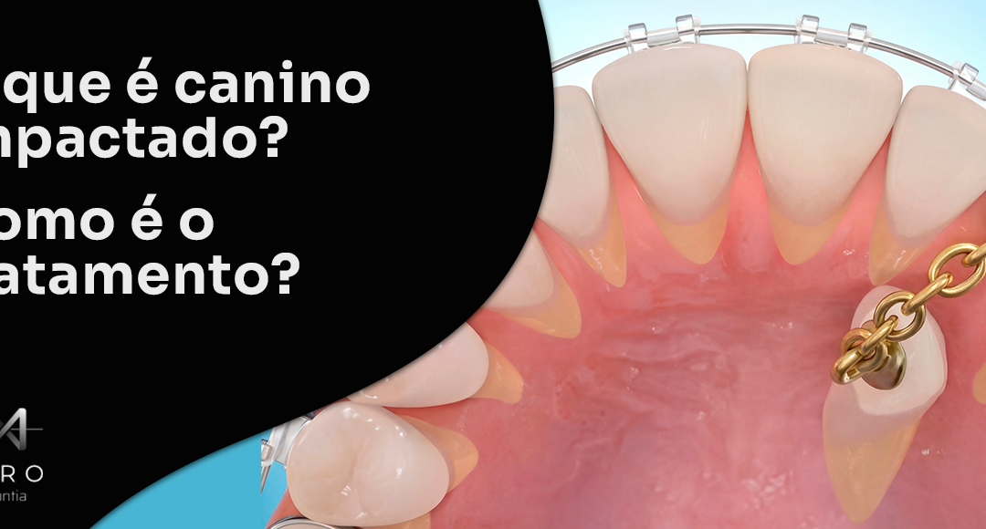 O que é canino impactado? Como é o tratamento?