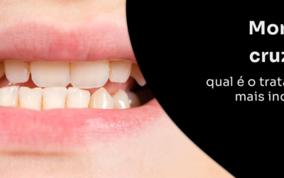 Mordida cruzada: qual é o tratamento mais indicado?