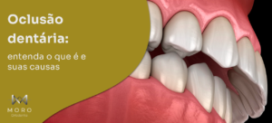 Oclusão dentária: entenda o que é e suas causas