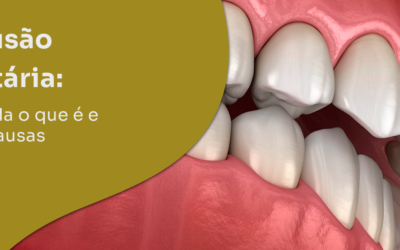 Oclusão dentária: entenda o que é e suas causas