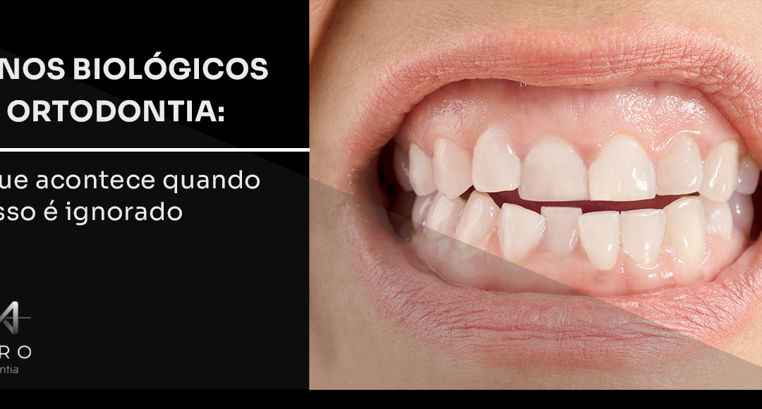 [BLOG 20/04] Danos biológicos na ortodontia: o que acontece quando o osso é ignorado