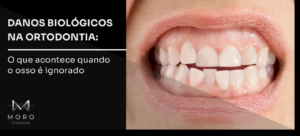 [BLOG 20/04] Danos biológicos na ortodontia: o que acontece quando o osso é ignorado