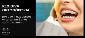 Recidiva ortodôntica: por que meus dentes entortaram 5 anos após o aparelho?