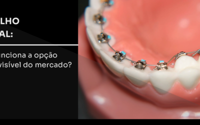 Aparelho lingual: como funciona a opção 100% invisível do mercado?