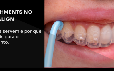 Attachments no Invisalign: para que servem e por que são vitais para o movimento
