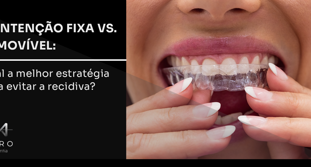 Contenção fixa vs. removível: qual a melhor estratégia para evitar a recidiva?