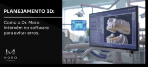 Planejamento 3D: como o Dr. Moro intervém no software para evitar erros.
