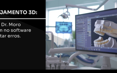 Planejamento 3D: como o Dr. Moro intervém no software para evitar erros.