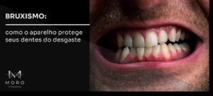 Bruxismo: como o aparelho protege seus dentes do desgaste