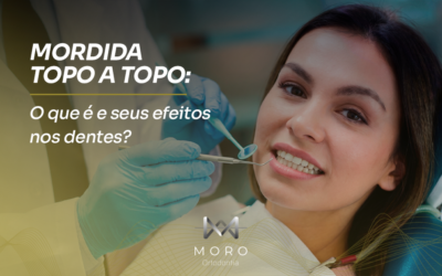 Mordida topo a topo: o que é e os efeitos nos dentes?