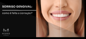 Sorriso gengival: como é feita a correção?