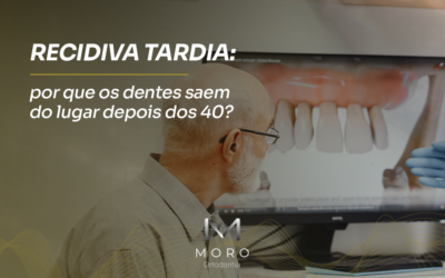 Recidiva tardia: por que os dentes saem do lugar depois dos 40? | Moro Ortodontia