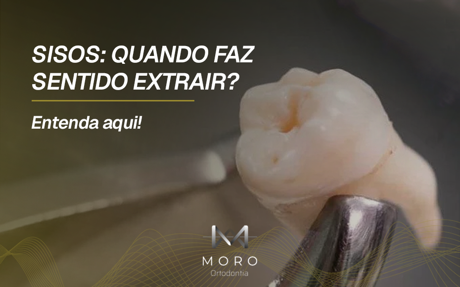 Sisos: quando faz sentido extrair? Entenda aqui