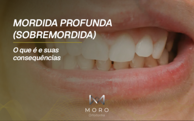 Mordida profunda: o efeito guilhotina e suas consequências